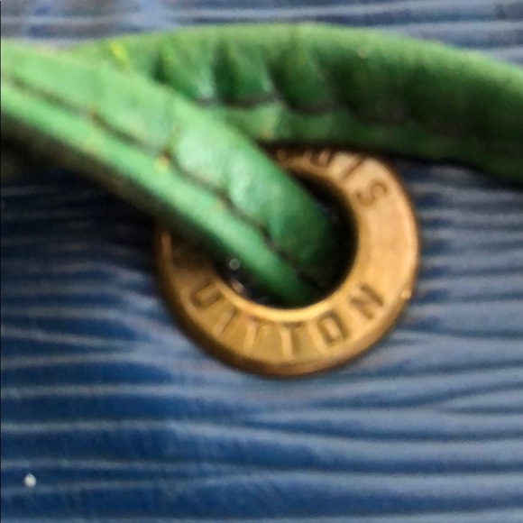 Large LV Epi Noe - Picture 5 of 9